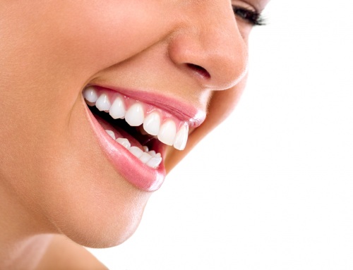 ¿Cómo estimar la duración de un blanqueamiento dental?